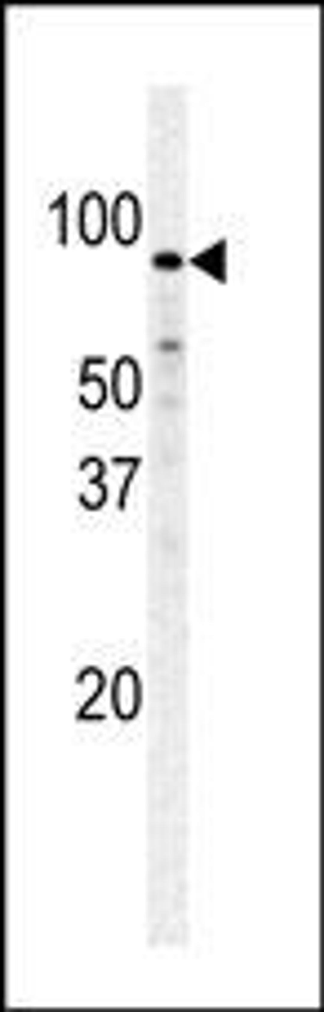 Western blot analysis of PFKM polyclonal antibody in Hela cell line lysate