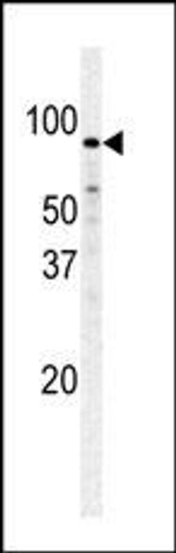 Western blot analysis of PFKM polyclonal antibody in Hela cell line lysate