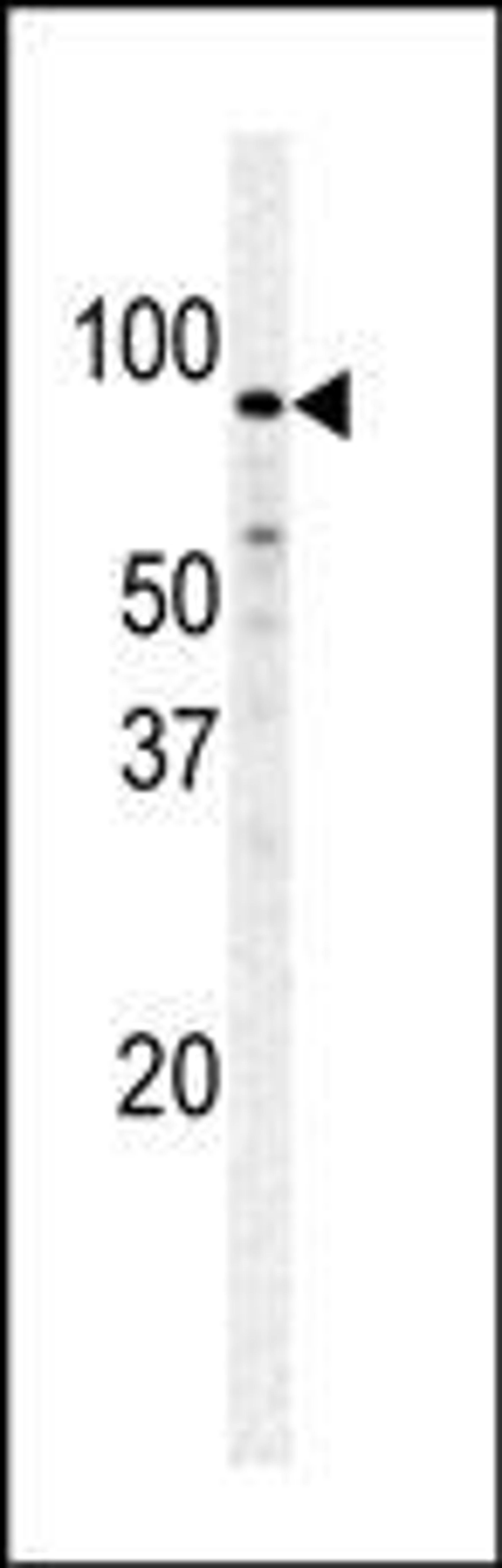 Western blot analysis of PFKM polyclonal antibody in Hela cell line lysate