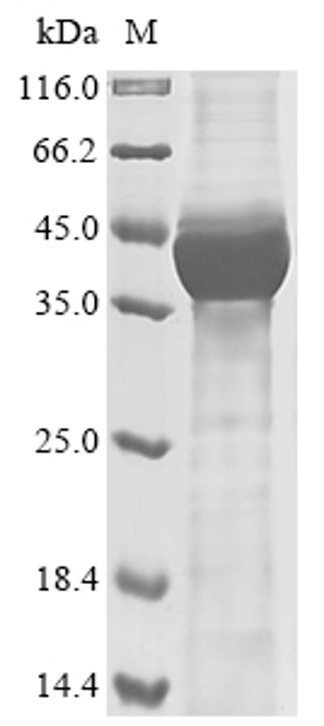 (Tris-Glycine gel) Discontinuous SDS-PAGE (reduced) with 5% enrichment gel and 15% separation gel.