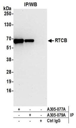 Detection of human RTCB by western blot of immunoprecipitates.