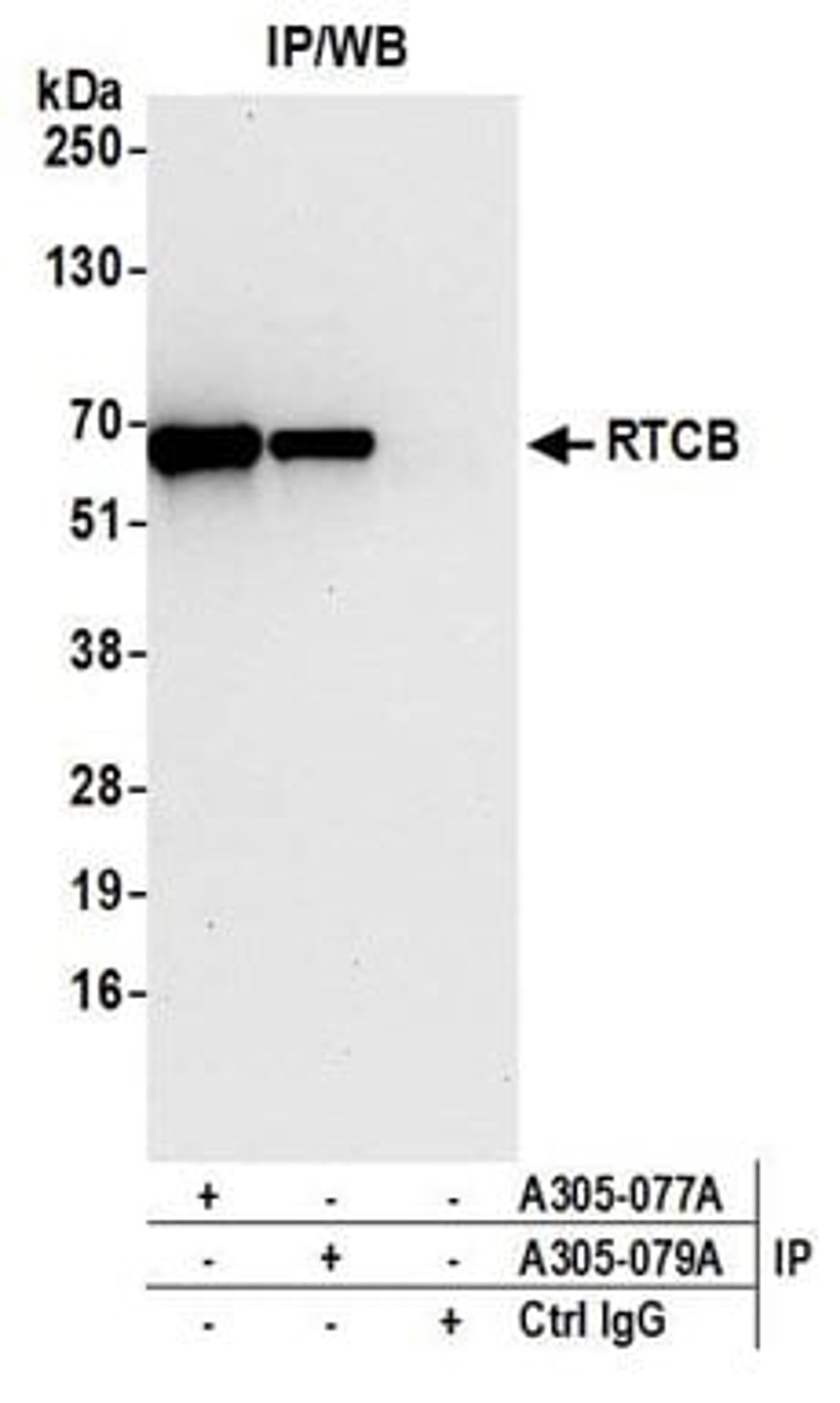 Detection of human RTCB by western blot of immunoprecipitates.