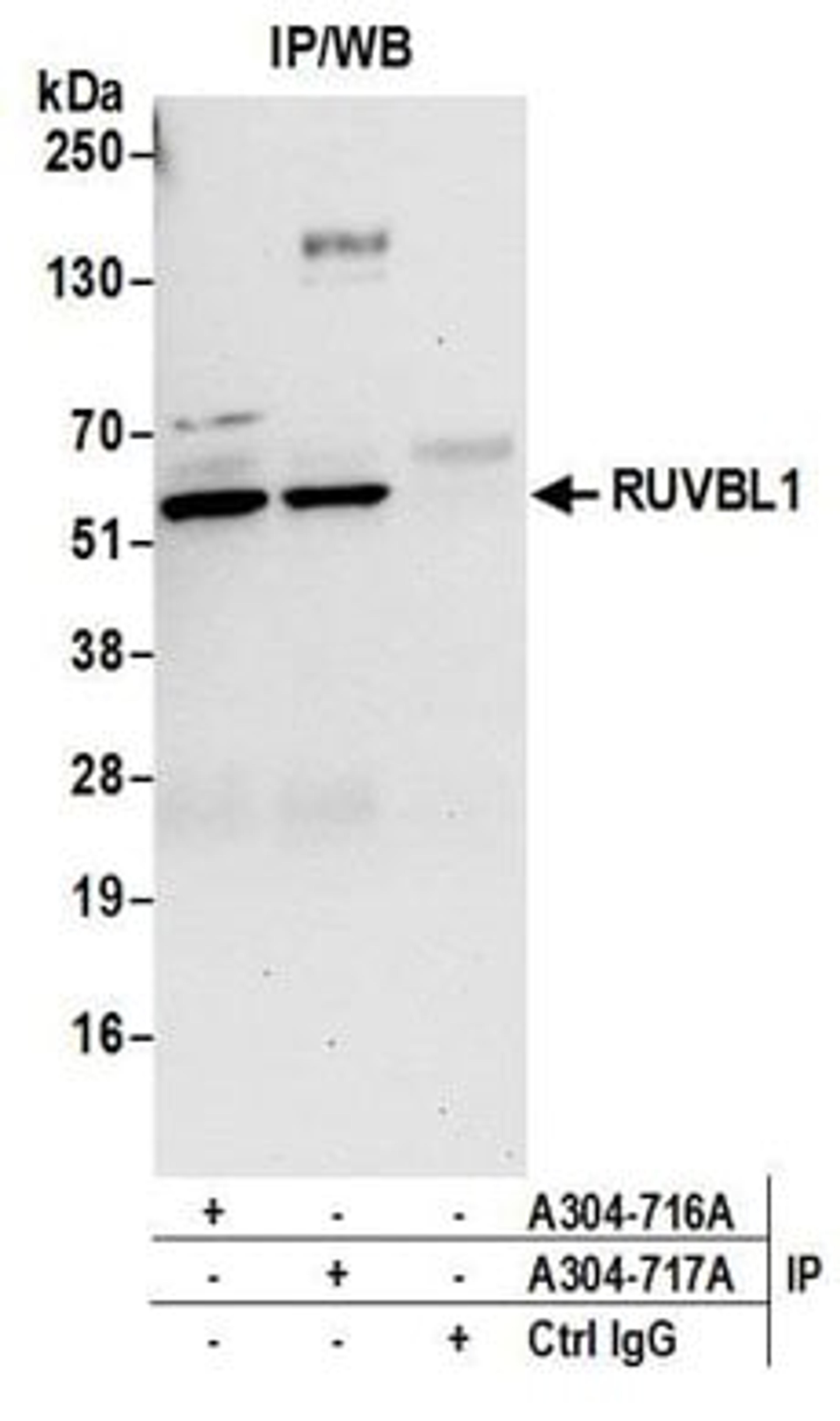 Detection of human RUVBL1 by western blot of immunoprecipitates.