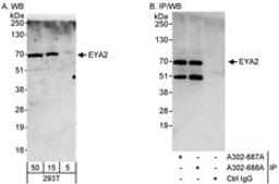 Detection of human EYA2 by western blot and immunoprecipitation.