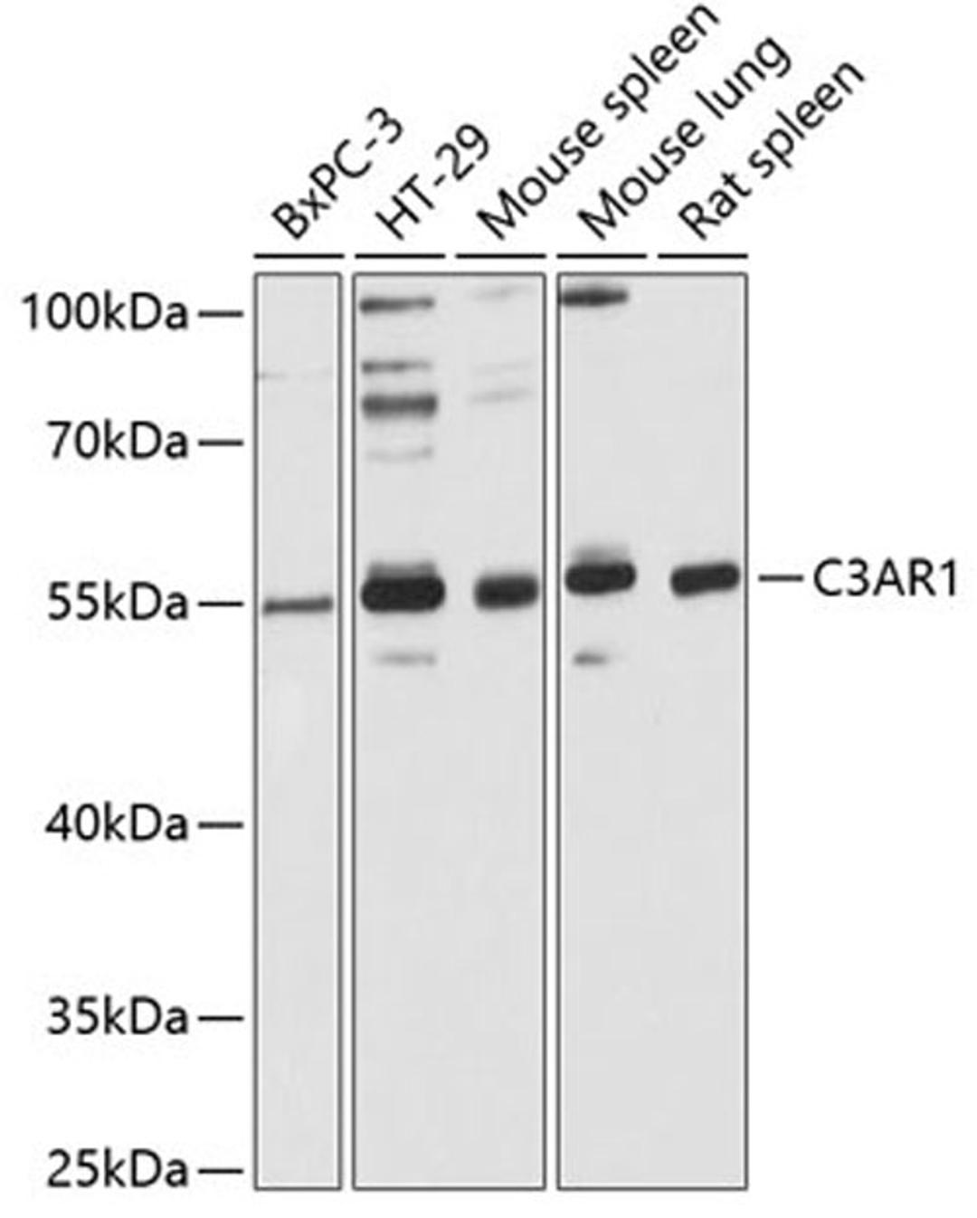 Western blot - C3AR1 Antibody (A6361)