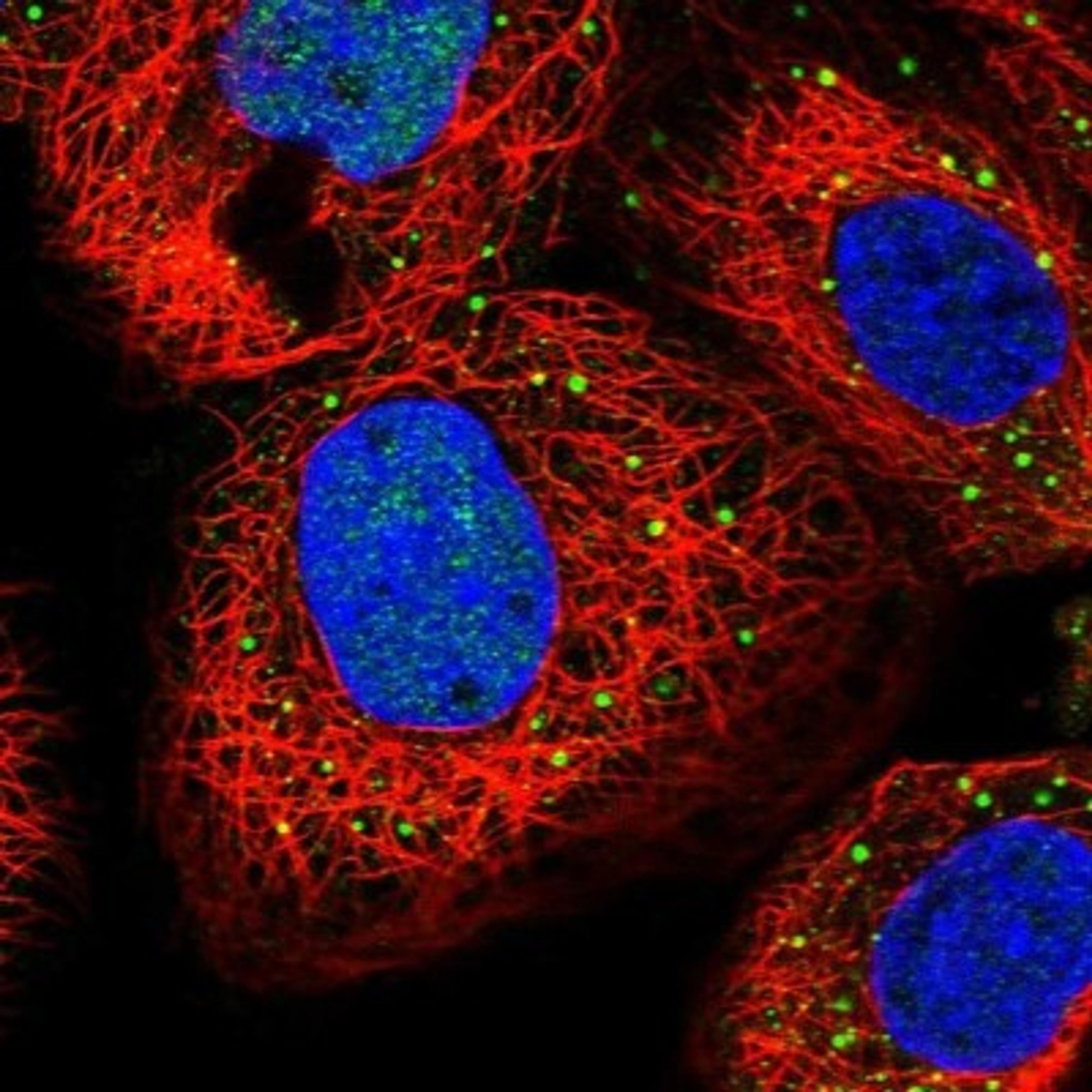 Immunocytochemistry/Immunofluorescence: RFC3 Antibody [NBP1-82668] - Staining of human cell line A-431 shows positivity in nucleus but not nucleoli & vesicles.