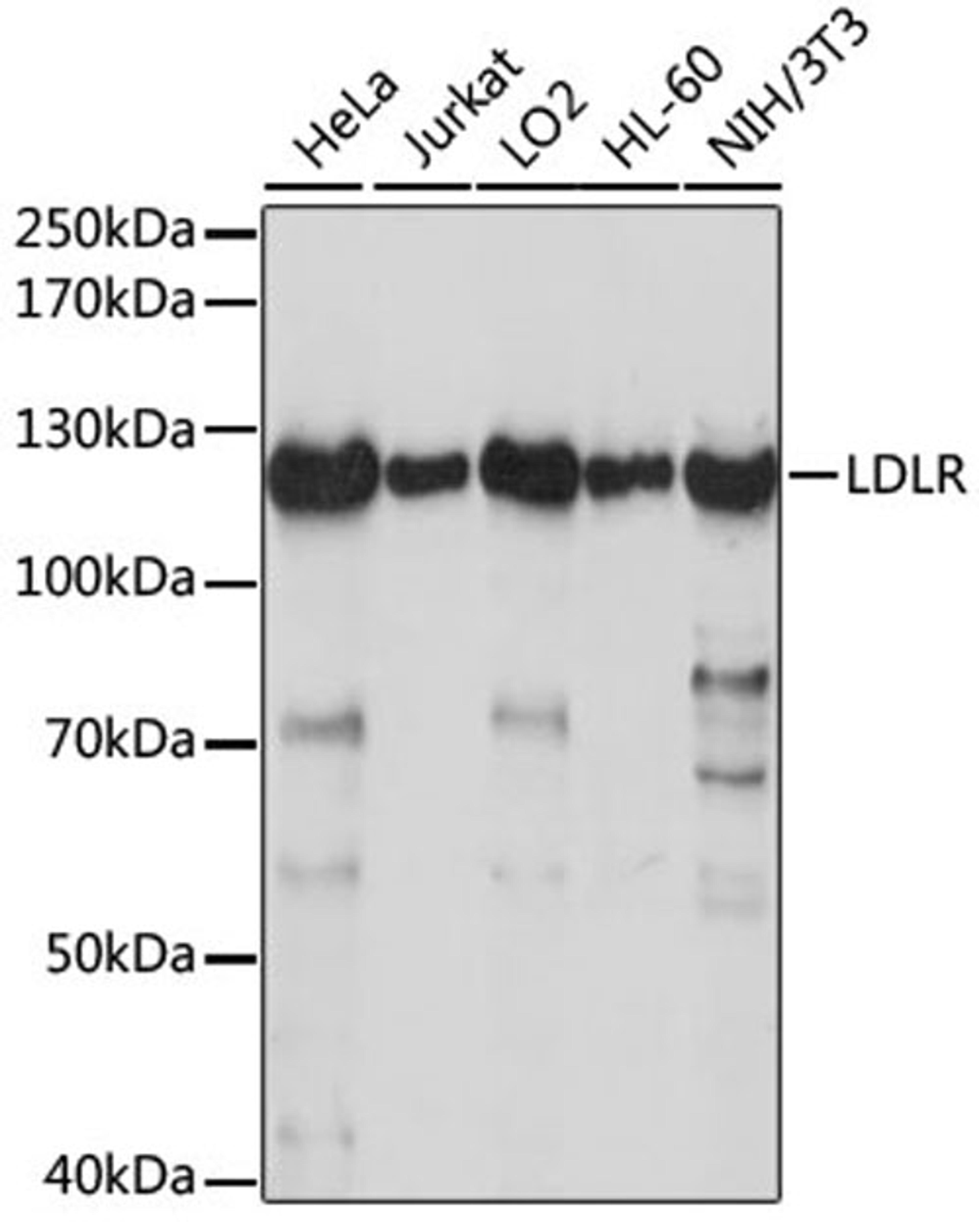 Western blot - LDLR antibody (A14996)