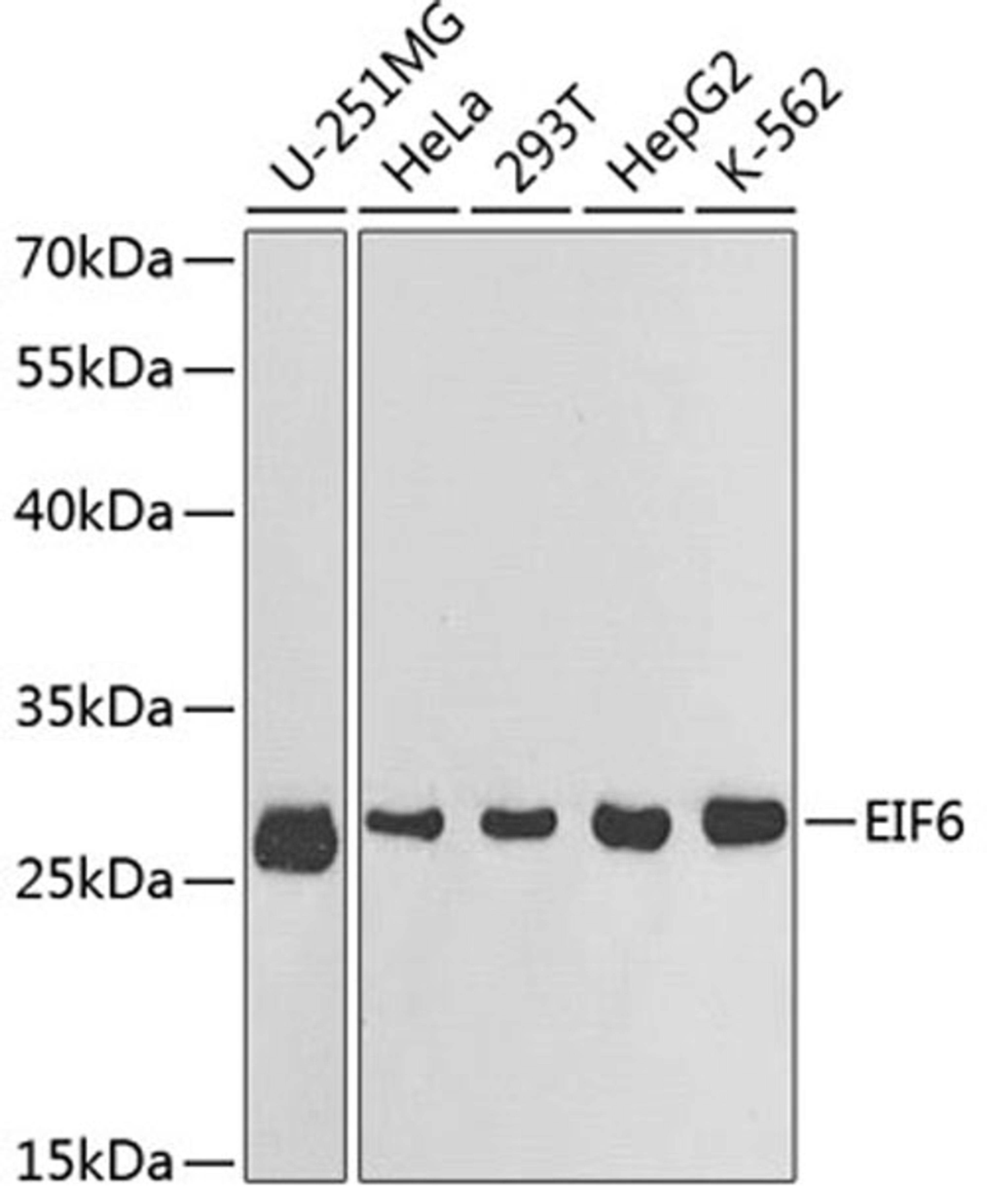 Western blot - EIF6 antibody (A1818)