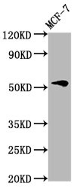 Western Blot. Positive WB detected in: MCF-7 whole cell lysate. All lanes: VTN antibody at 4.6µg/ml. Secondary. Goat polyclonal to rabbit IgG at 1/50000 dilution. Predicted band size: 55 kDa. Observed band size: 55 kDa