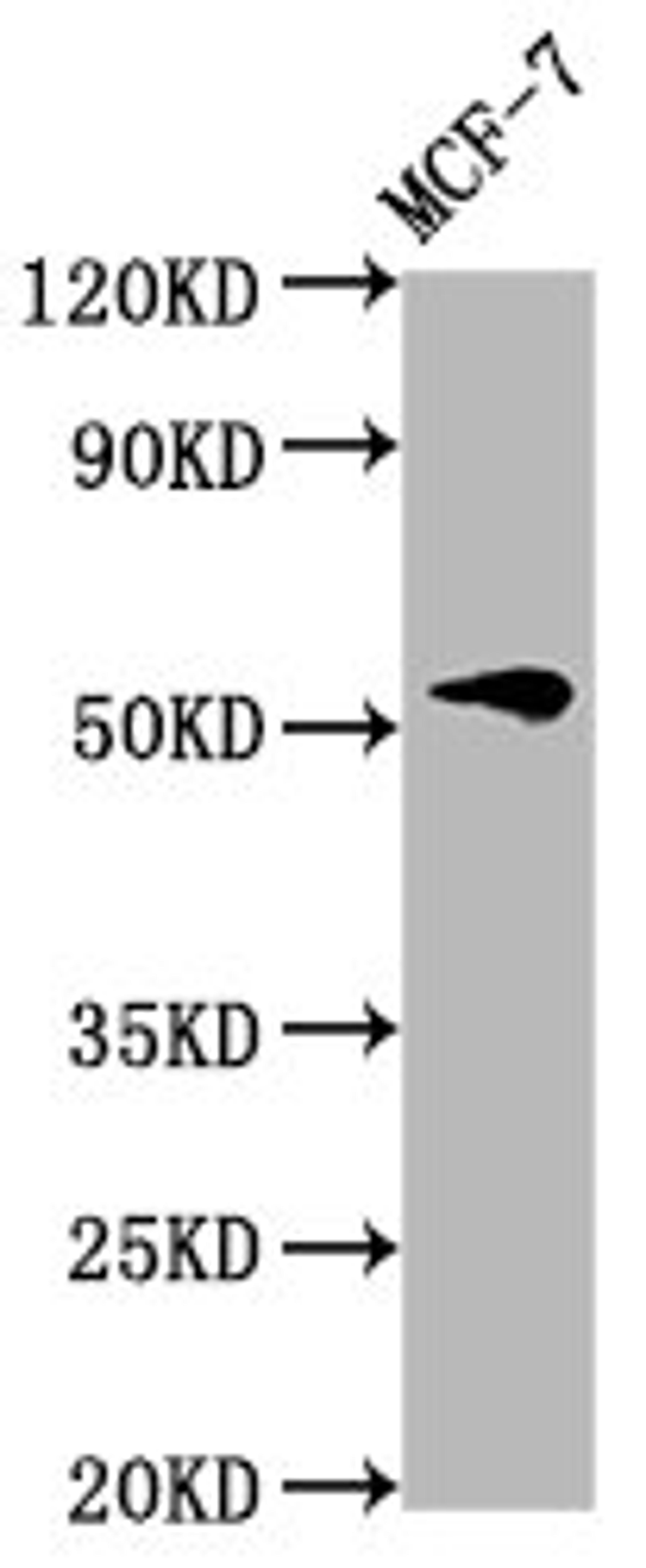 Western Blot. Positive WB detected in: MCF-7 whole cell lysate. All lanes: VTN antibody at 4.6µg/ml. Secondary. Goat polyclonal to rabbit IgG at 1/50000 dilution. Predicted band size: 55 kDa. Observed band size: 55 kDa