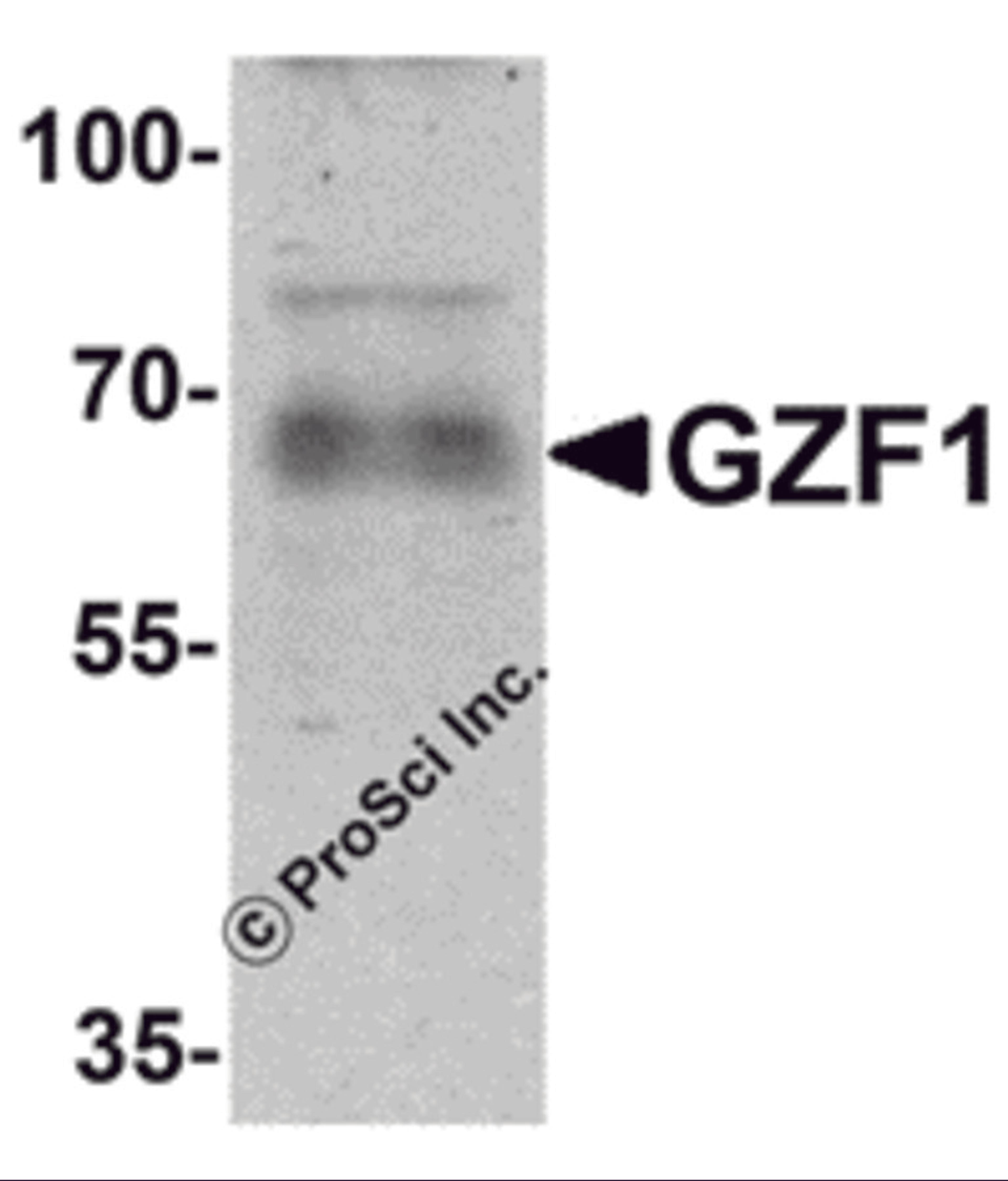 Western blot analysis of GZF1 in human heart tissue lysate with GZF1 antibody at 1 &#956;g/mL.