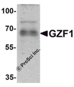Western blot analysis of GZF1 in human heart tissue lysate with GZF1 antibody at 1 μg/mL.