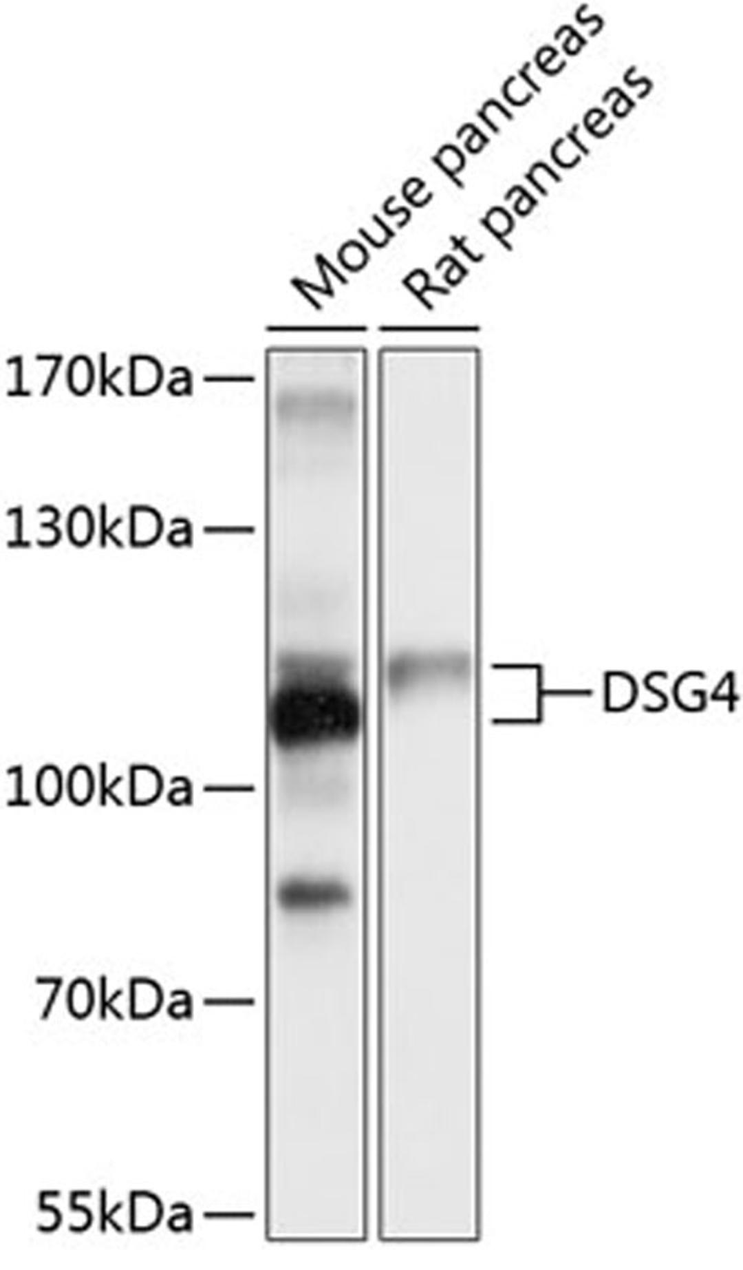 Western blot - DSG4 antibody (A10502)