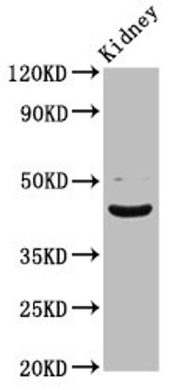 Western Blot. Positive WB detected in: Rat kidney tissue. All lanes: LHX2 antibody at 5.43ug/ml. Secondary. Goat polyclonal to rabbit IgG at 1/50000 dilution. Predicted band size: 45 kDa. Observed band size: 45 kDa.