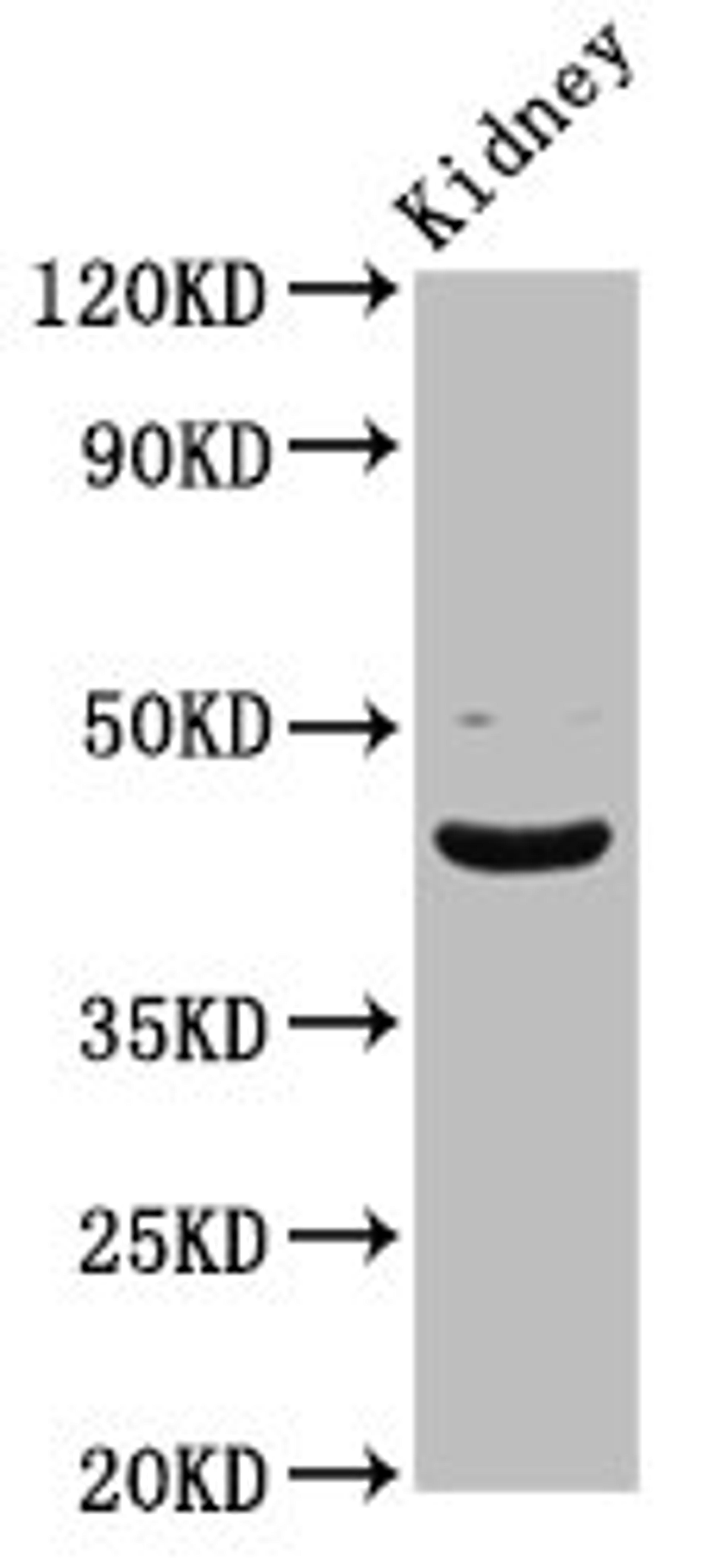 Western Blot. Positive WB detected in: Rat kidney tissue. All lanes: LHX2 antibody at 5.43ug/ml. Secondary. Goat polyclonal to rabbit IgG at 1/50000 dilution. Predicted band size: 45 kDa. Observed band size: 45 kDa.