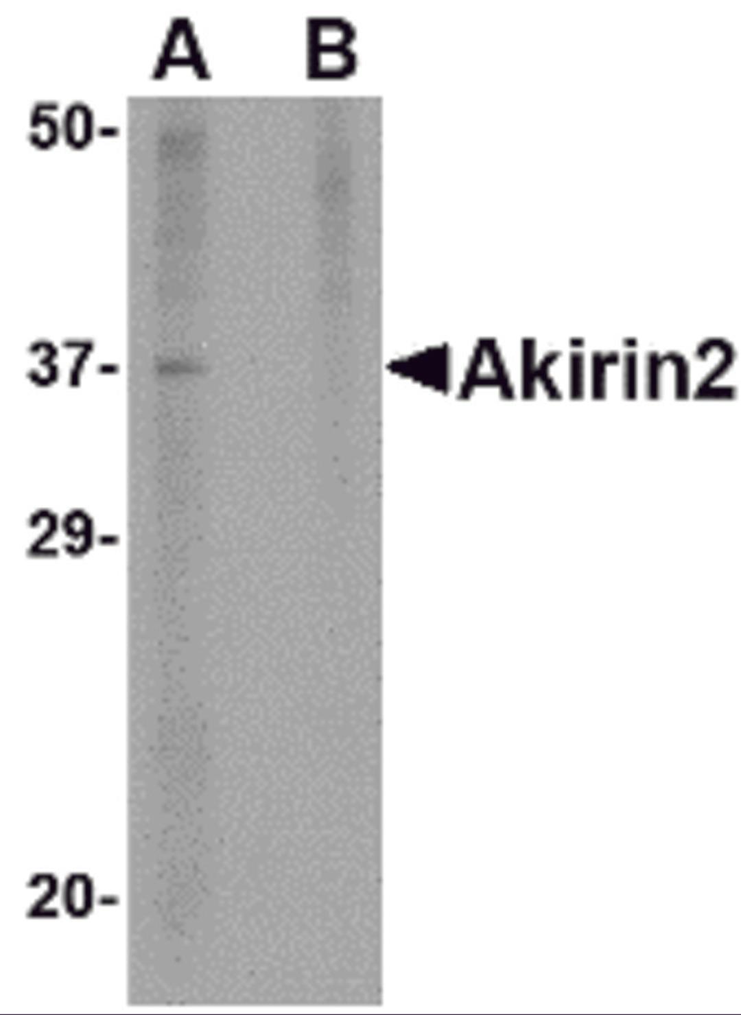 Western blot analysis of Akirin2 in mouse brain tissue lysate with Akirin2 antibody at 1 &#956;g/mL in (A) the absence and (B) the presence of blocking peptide.