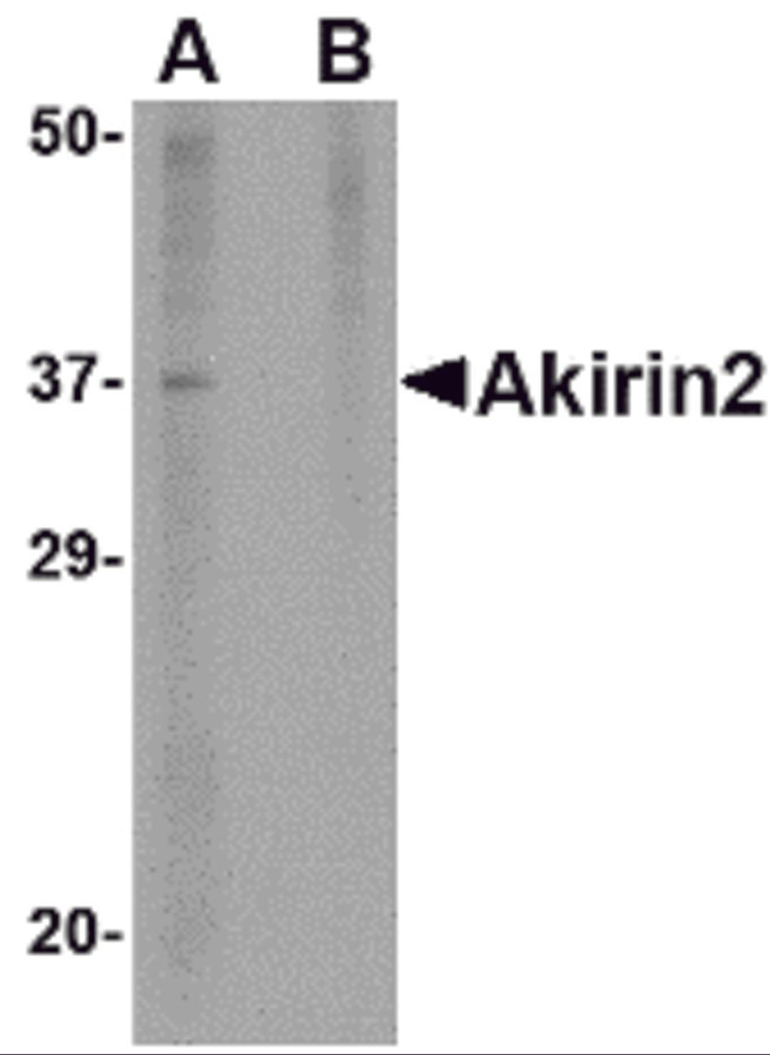 Western blot analysis of Akirin2 in mouse brain tissue lysate with Akirin2 antibody at 1 μg/mL in (A) the absence and (B) the presence of blocking peptide.