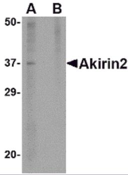 Western blot analysis of Akirin2 in mouse brain tissue lysate with Akirin2 antibody at 1 μg/mL in (A) the absence and (B) the presence of blocking peptide.