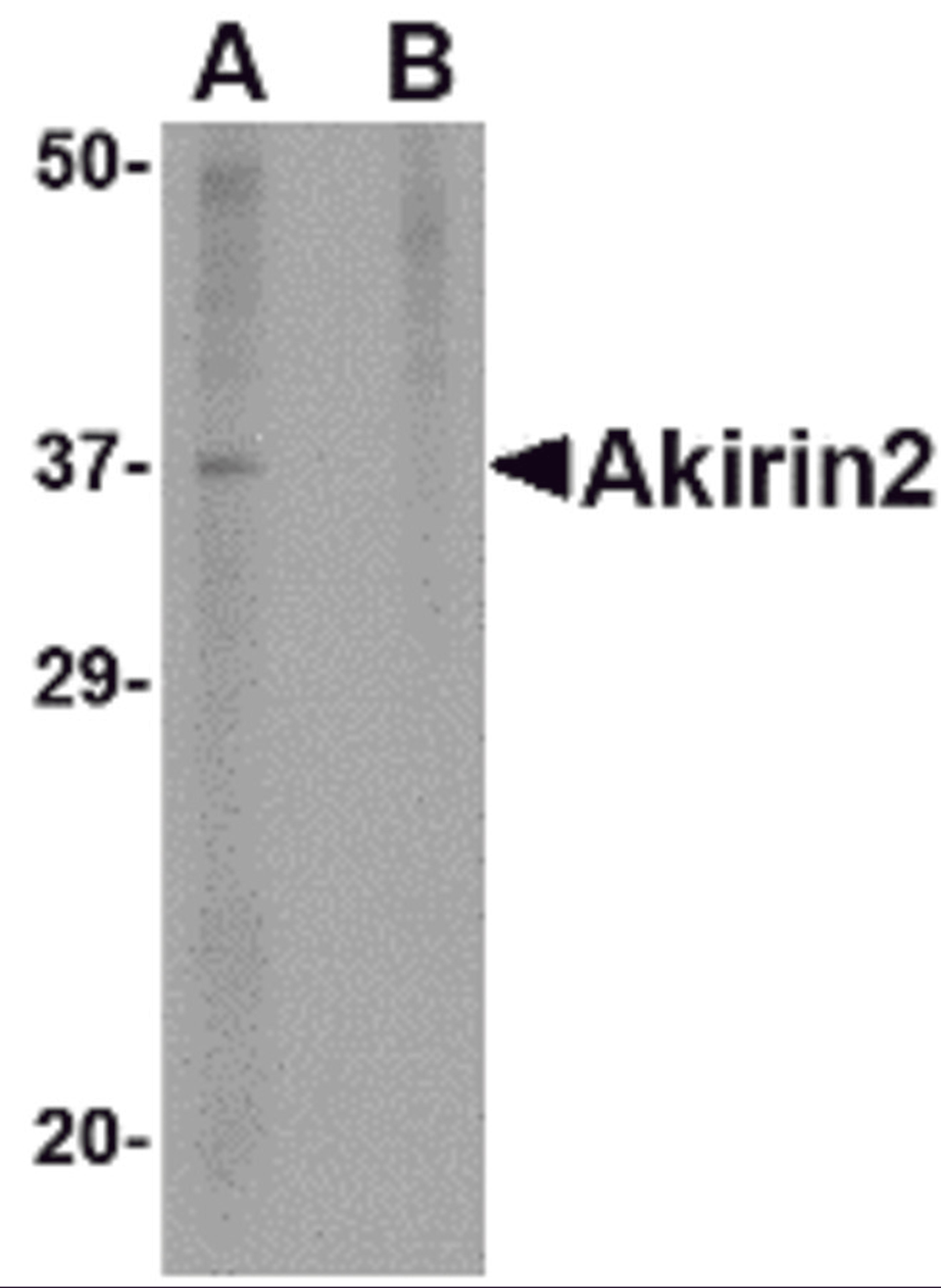 Western blot analysis of Akirin2 in mouse brain tissue lysate with Akirin2 antibody at 1 μg/mL in (A) the absence and (B) the presence of blocking peptide.