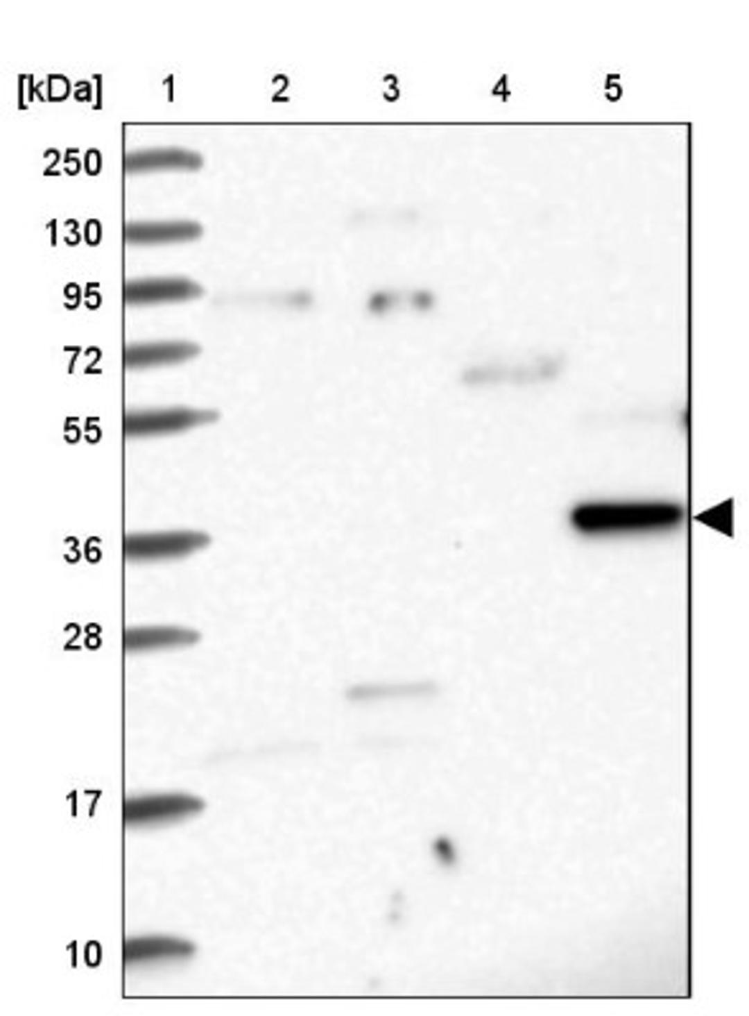 Western Blot: RASSF4 Antibody [NBP1-89249] - Lane 1: Marker [kDa] 250, 130, 95, 72, 55, 36, 28, 17, 10<br/>Lane 2: Human cell line RT-4<br/>Lane 3: Human cell line U-251MG sp<br/>Lane 4: Human plasma (IgG/HSA depleted)<br/>Lane 5: Human liver tissue