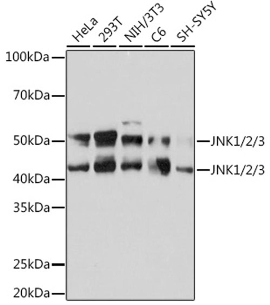 Western blot - JNK1/2/3 Rabbit mAb (A4867)