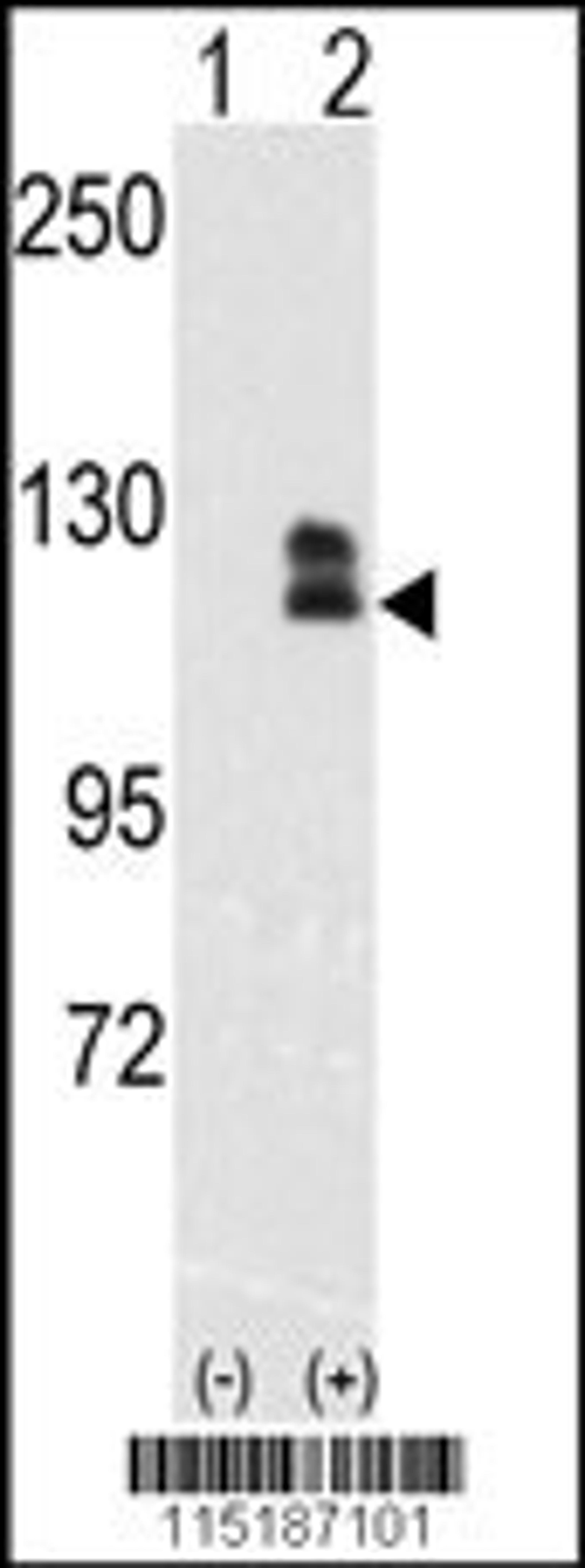 Western blot analysis of EphB2 using rabbit polyclonal EphB2 Antibody.293 cell lysates (2 ug/lane) either nontransfected (Lane 1) or transiently transfected with the EphB2 gene (Lane 2).