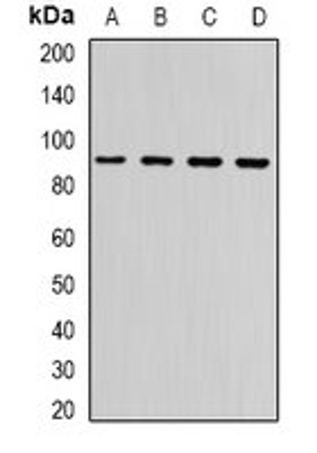 Western blot analysis of Hela (Lane1), A549 (Lane2), mouse brain (Lane3), rat brain (Lane4) whole cell lysates using NLGN4Y antibody