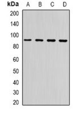 Western blot analysis of Hela (Lane1), A549 (Lane2), mouse brain (Lane3), rat brain (Lane4) whole cell lysates using NLGN4Y antibody