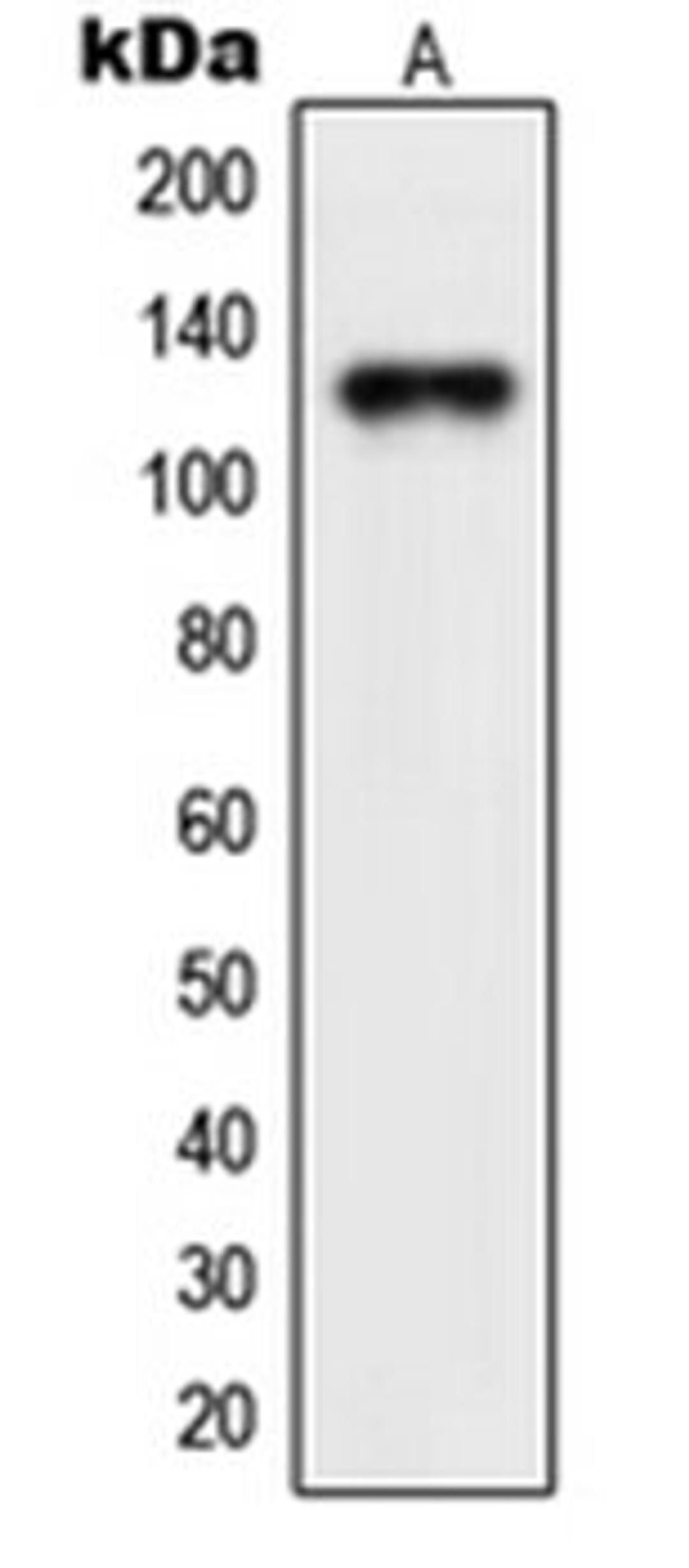 Western blot analysis of Jurkat (Lane 1) whole cell lysates using NEMF antibody