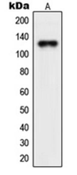 Western blot analysis of Jurkat (Lane 1) whole cell lysates using NEMF antibody