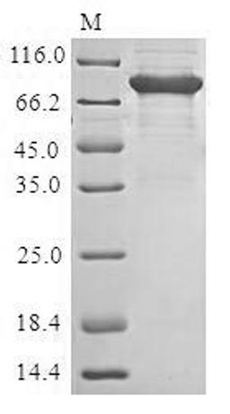 (Tris-Glycine gel) Discontinuous SDS-PAGE (reduced) with 5% enrichment gel and 15% separation gel.