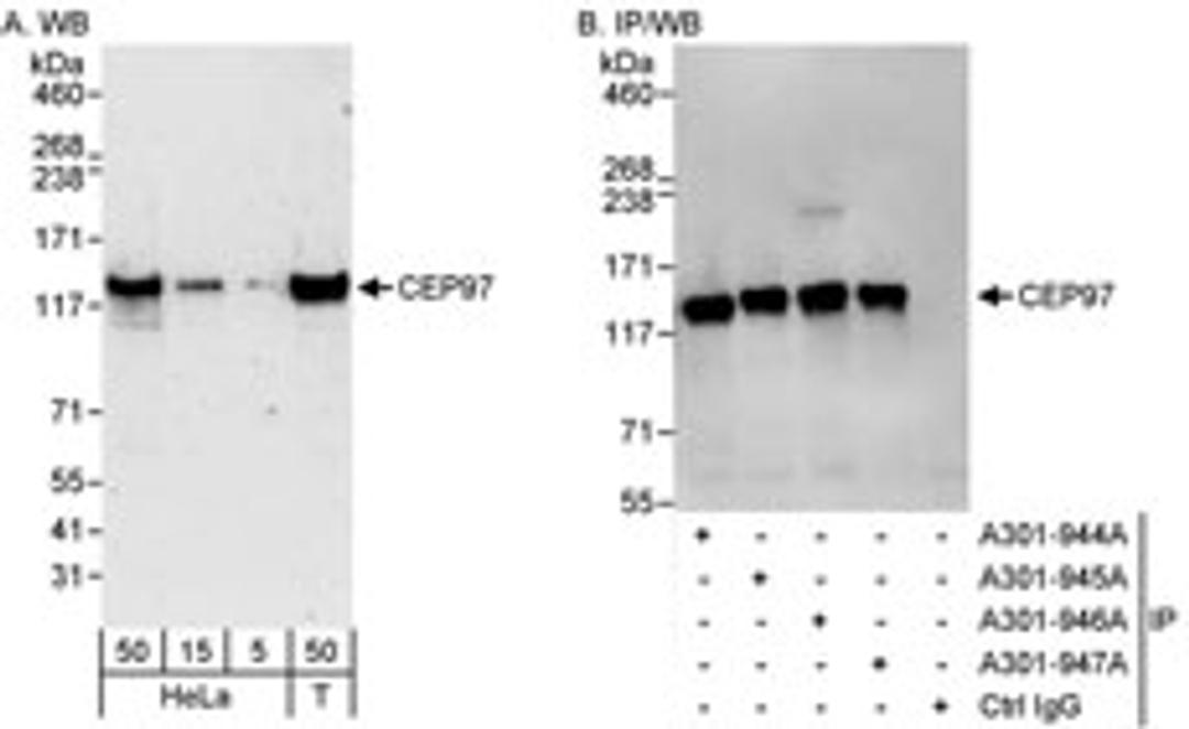 Detection of human CEP97 by western blot and immunoprecipitation.