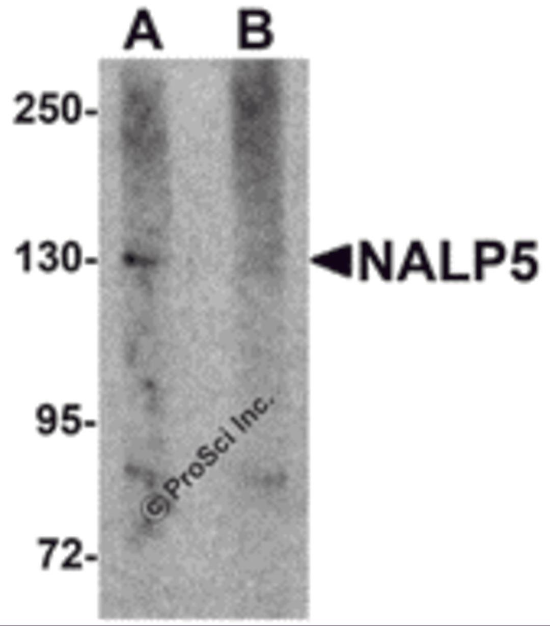 Western blot analysis of NALP5 in mouse brain tissue lysate with NALP5 antibody at 1 &#956;g/mL in (A) the absence and (B) the presence of blocking peptide.