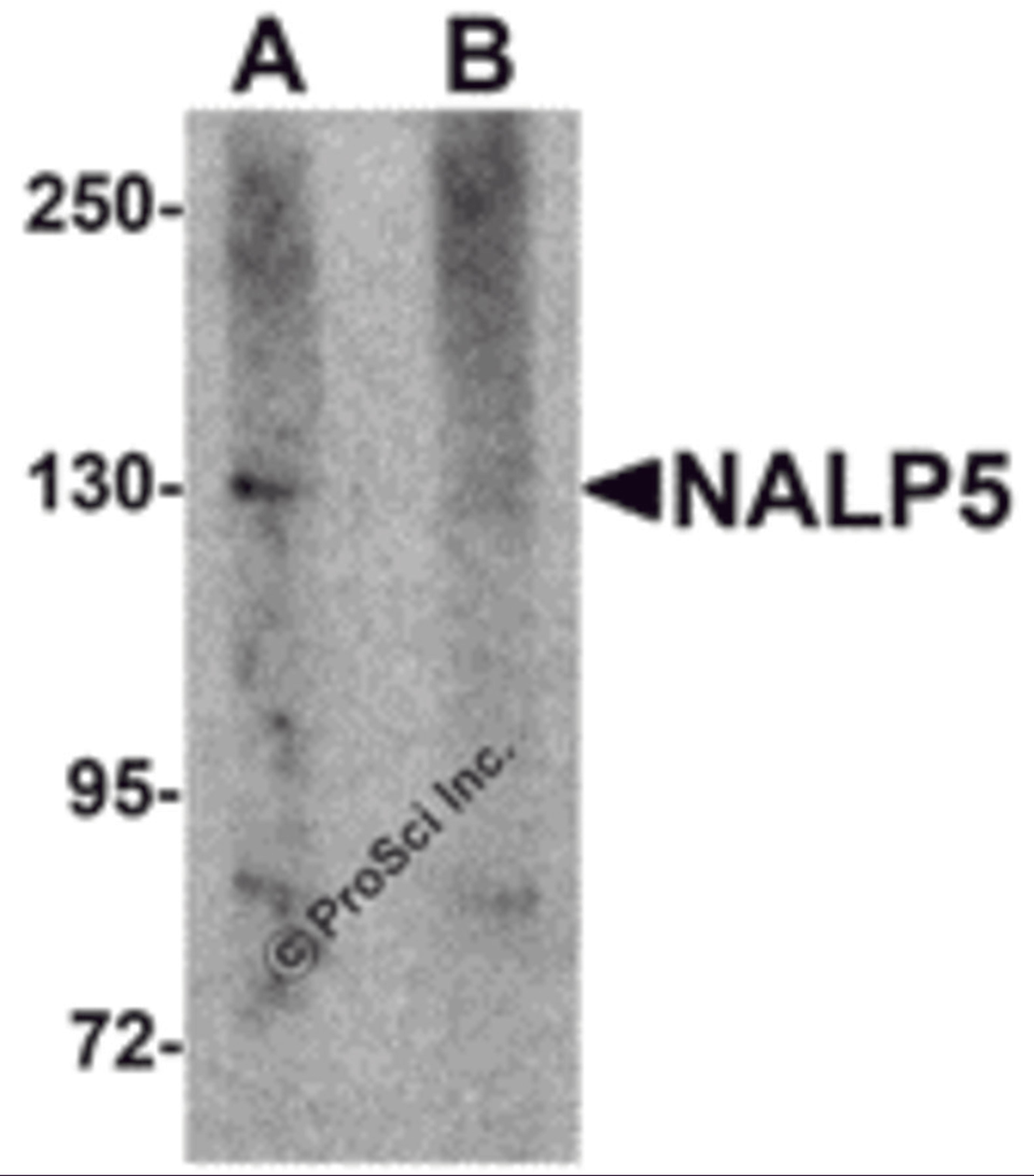 Western blot analysis of NALP5 in mouse brain tissue lysate with NALP5 antibody at 1 &#956;g/mL in (A) the absence and (B) the presence of blocking peptide.