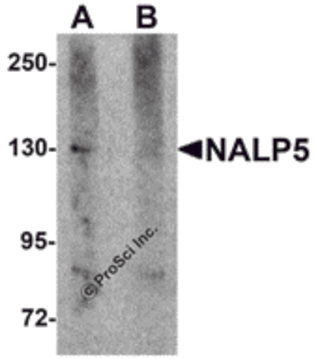Western blot analysis of NALP5 in mouse brain tissue lysate with NALP5 antibody at 1 μg/mL in (A) the absence and (B) the presence of blocking peptide.
