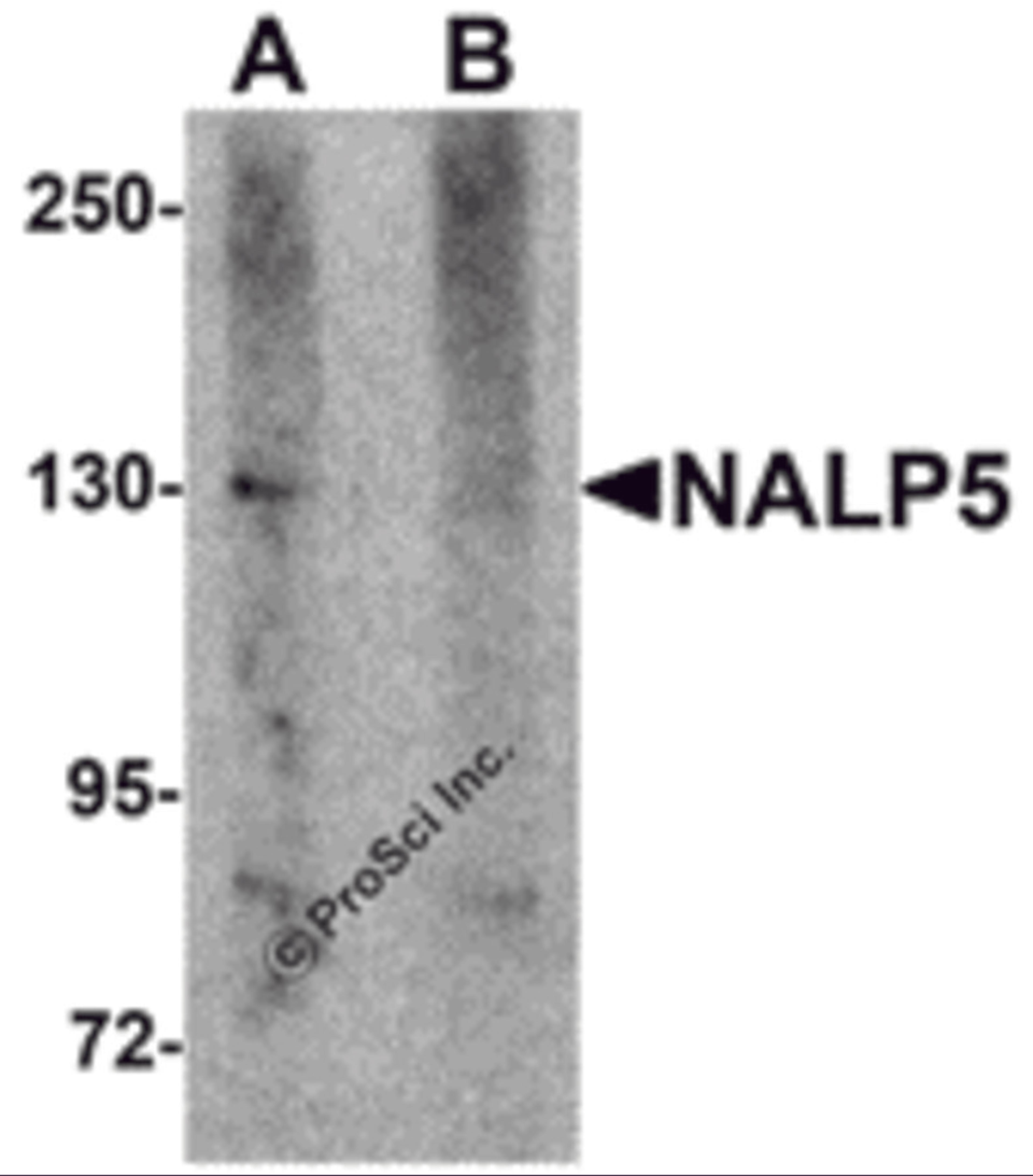 Western blot analysis of NALP5 in mouse brain tissue lysate with NALP5 antibody at 1 μg/mL in (A) the absence and (B) the presence of blocking peptide.