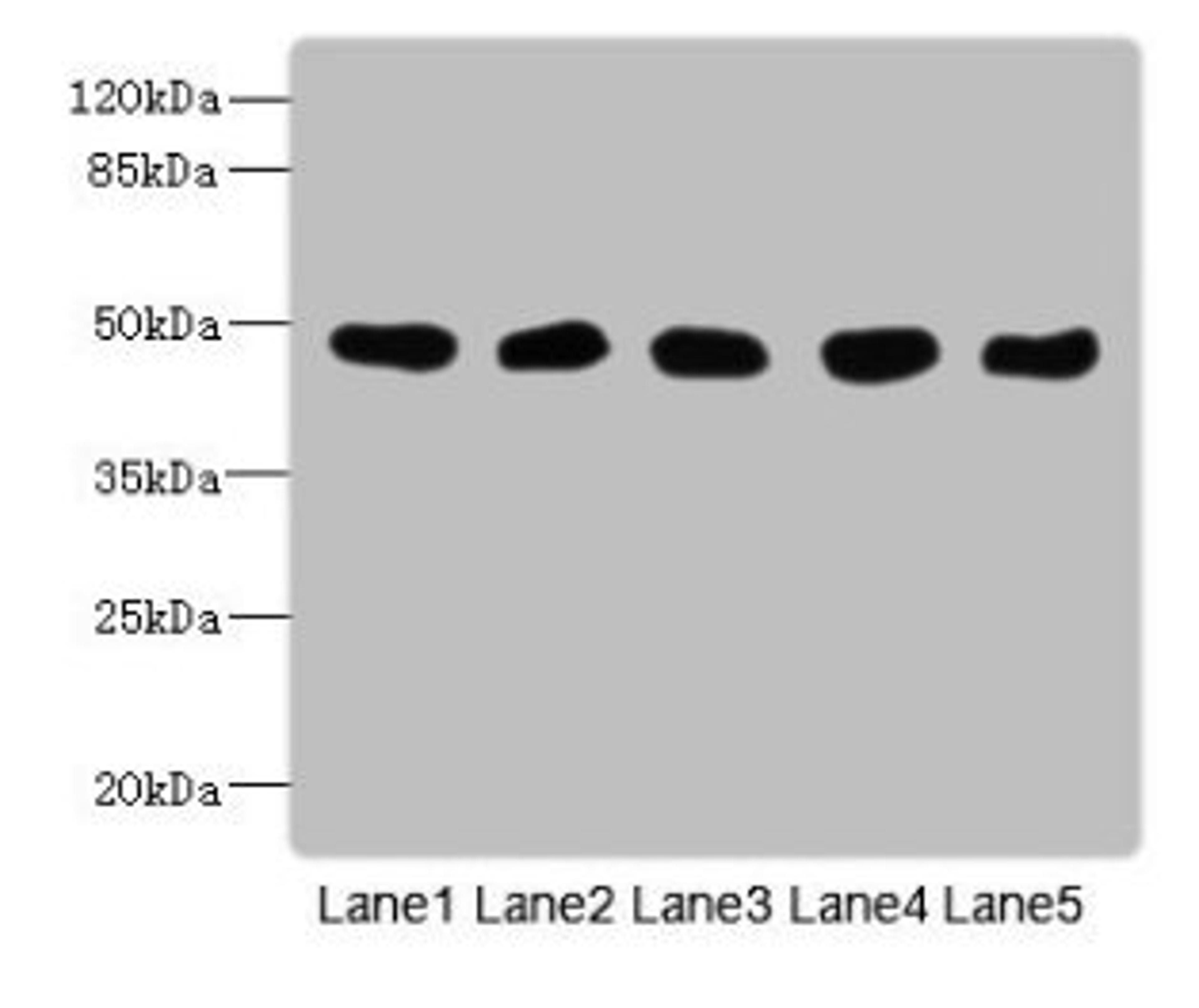 Western Blot. All lanes: GCDH antibody at 8µg/ml. Lane 1: Mouse kidney tissue. Lane 2: Mouse liver tissue. Lane 3: Hela whole cell lysate. Lane 4: MCF-7 whole cell lysate. Lane 5: LO2 whole cell lysate. Secondary. Goat polyclonal to rabbit IgG at 1/10000 dilution. Predicted band size: 49, 48 kDa. Observed band size: 49 kDa