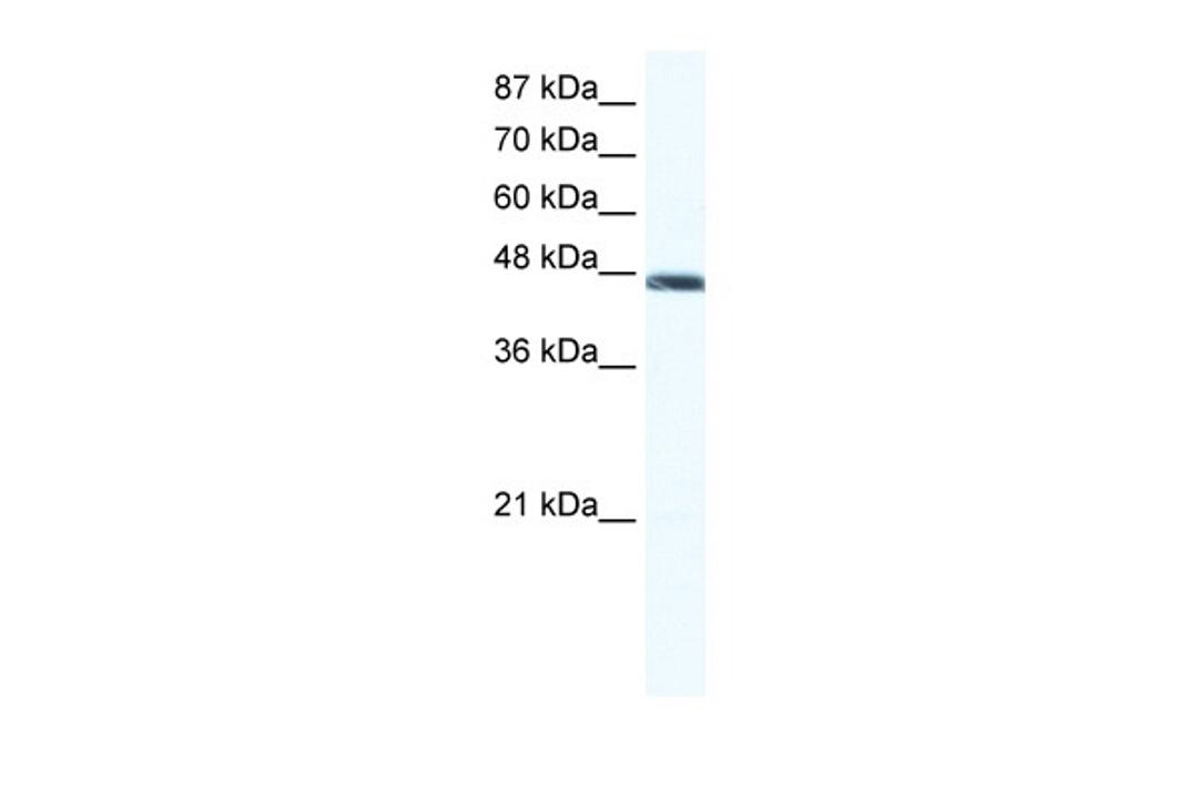 Antibody used in WB on Human Jurkat cells at 1.25 ug/ml.