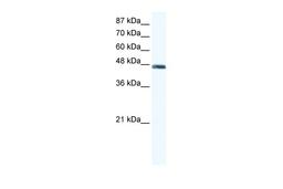 Antibody used in WB on Human Jurkat cells at 1.25 ug/ml.