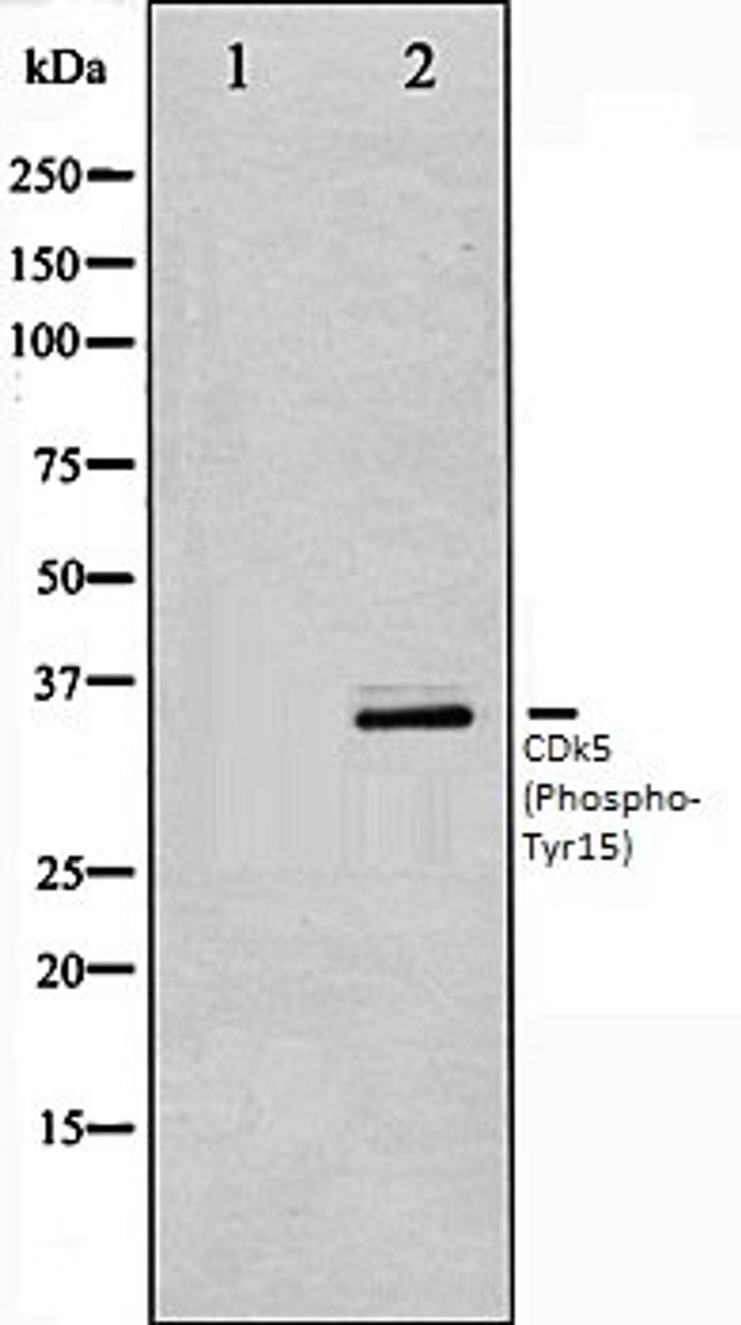 Western blot analysis of COS7 whole cell lysates using CDK5 (Phospho-Tyr15) antibody, The lane on the left is treated with the antigen-specific peptide.