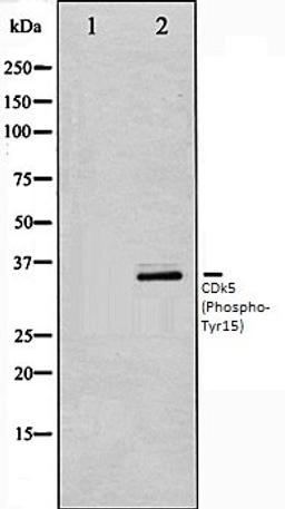 Western blot analysis of COS7 whole cell lysates using CDK5 (Phospho-Tyr15) antibody, The lane on the left is treated with the antigen-specific peptide.