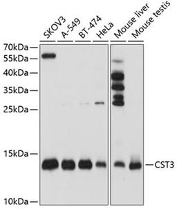 Western blot - CST3 antibody (A1561)