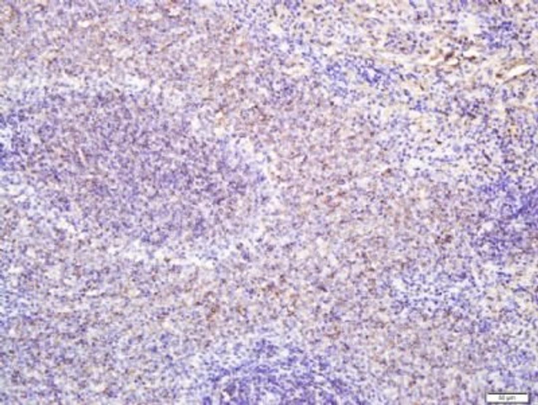 Immunohistochemical staining of rat spleen tissue using CD127 antibody.