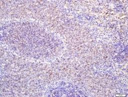 Immunohistochemical staining of rat spleen tissue using CD127 antibody.