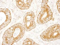 Detection of human MADD by immunohistochemistry.