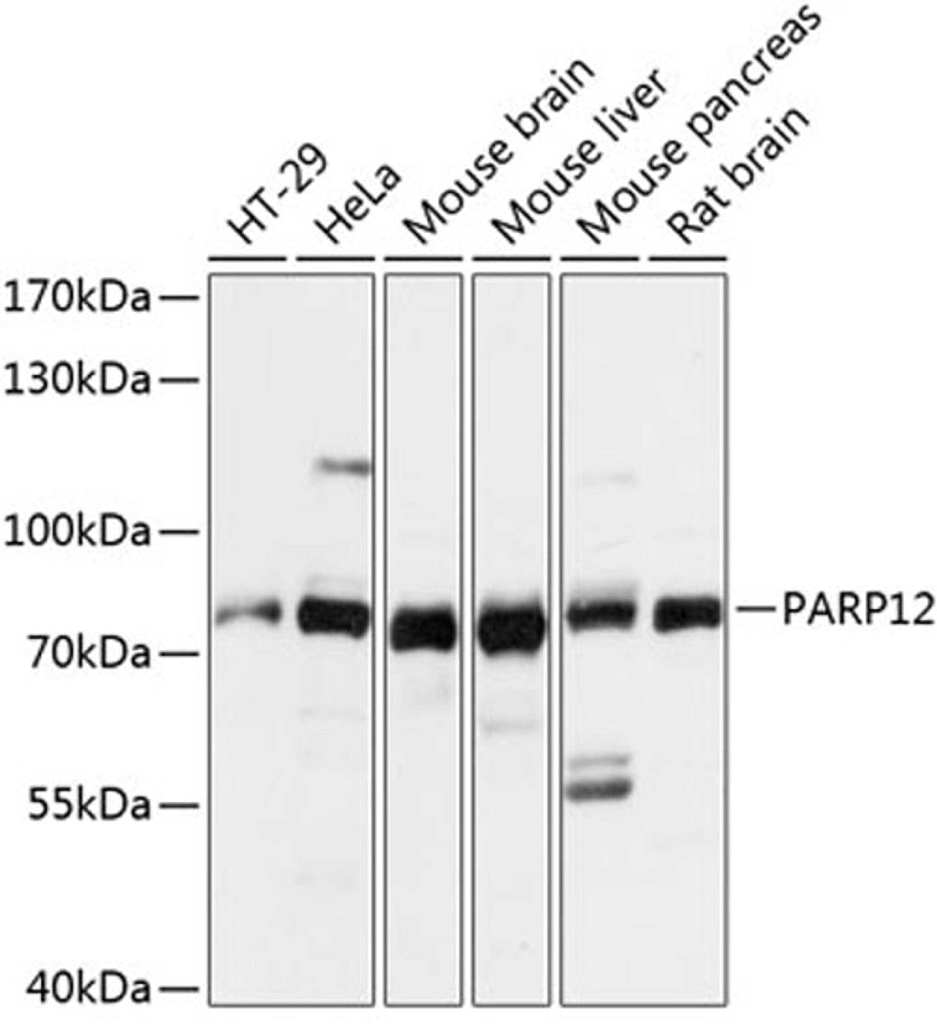 Western blot - PARP12 antibody (A14317)