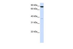 Antibody used in WB on Human 293T at 0.2-1 ug/ml.