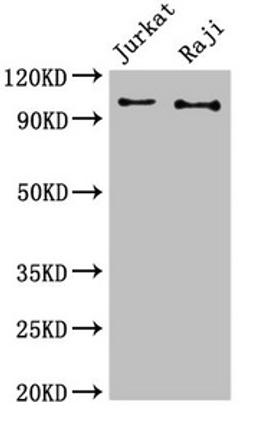 Western Blot. Positive WB detected in: Jurkat whole cell lysate, Raji whole cell lysate. All lanes: CBL antibody at 3µg/ml. Secondary. Goat polyclonal to rabbit IgG at 1/50000 dilution. Predicted band size: 100 kDa. Observed band size: 100 kDa