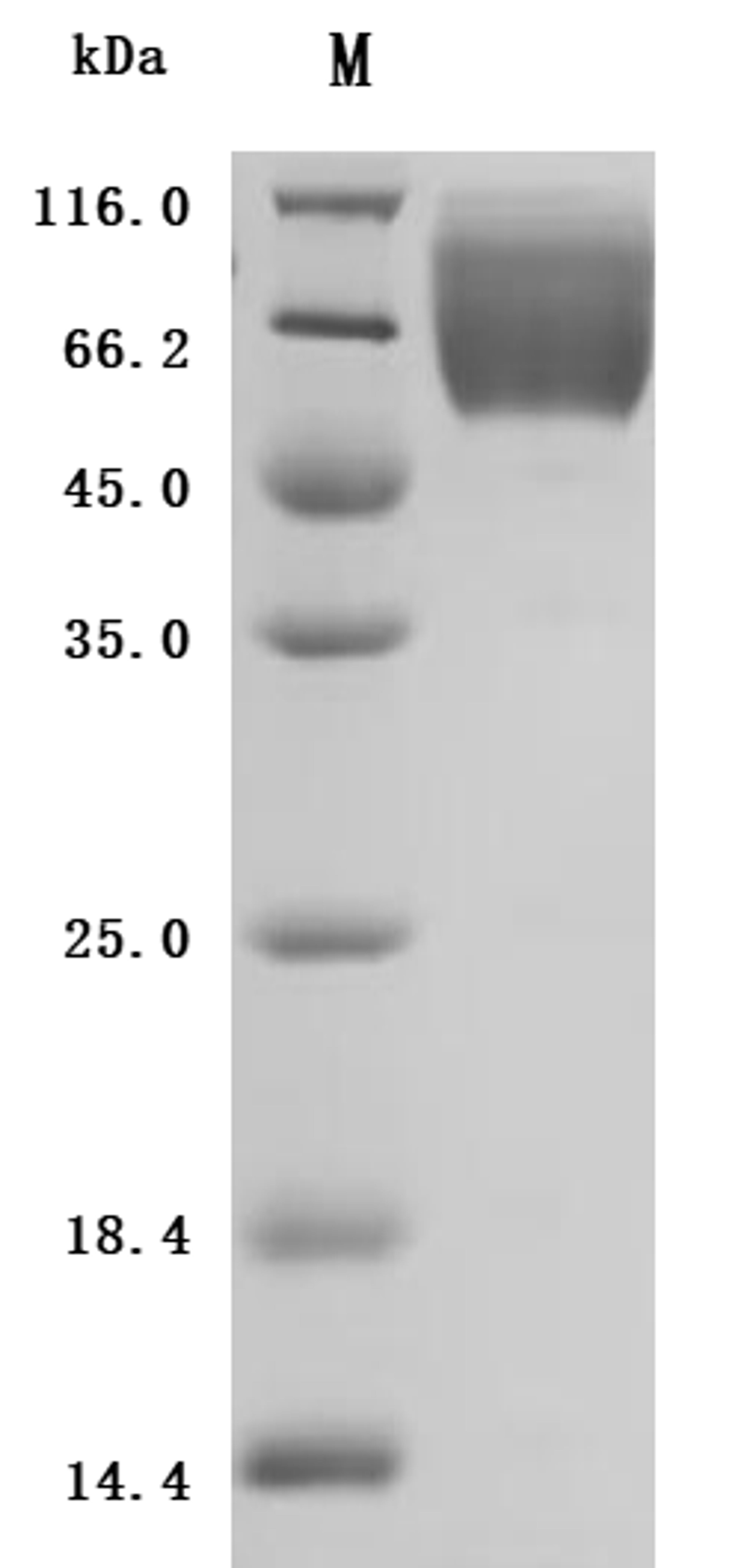 (Tris-Glycine gel) Discontinuous SDS-PAGE (reduced) with 5% enrichment gel and 15% separation gel.