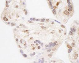 Detection of human NELFA by immunohistochemistry.